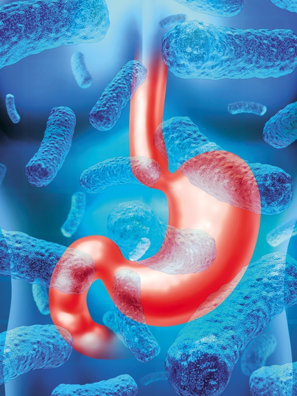 Gastroenteritis Bacterial Signs And Symptoms MIMS Malaysia